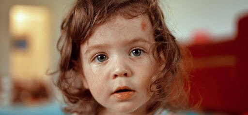 young girl has a red mark on her forehead Helland & Hurwitz Attorneys at Law Colorado